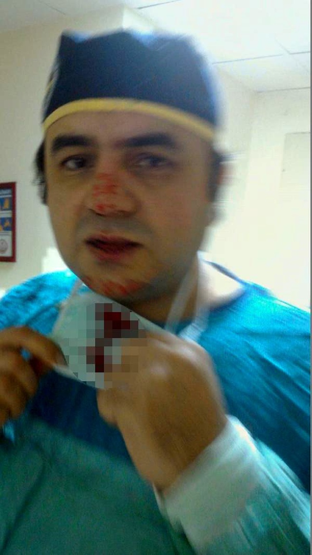 Doktor, burnunu kıran saldırganın eşine doğum yaptırdı