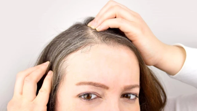 Stresin saçların beyazlamasını hızlandırdığı bilimsel olarak kanıtlandı