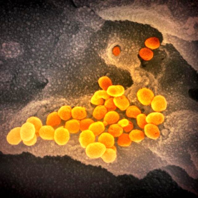 Yüzlerce insanın canını alan koronavirüsün fotoğrafları ilk kez yayımlandı