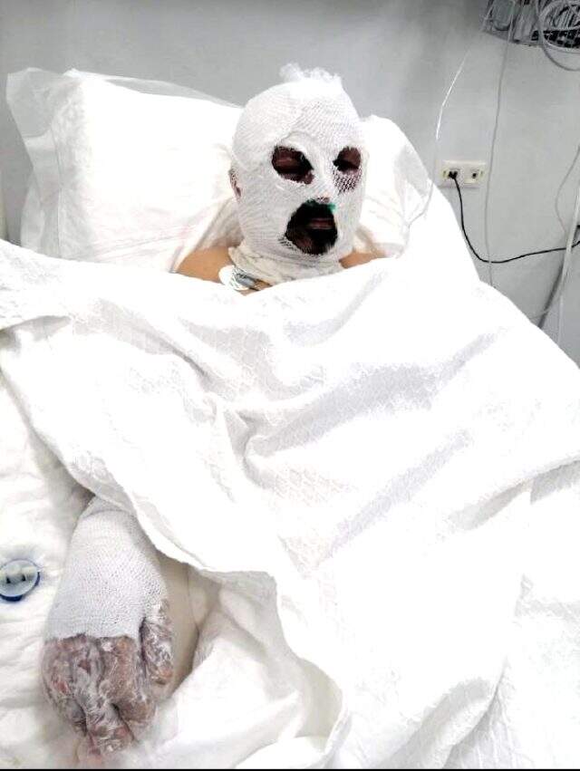Öğrenci servisi şoförünün üzerine tiner döküp yakan kadın tutuklandı