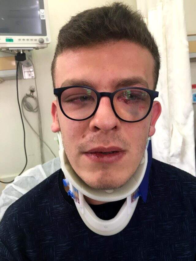 Avcılar'da otizmli genci darp eden saldırgan tahliye oldu Avcılar'da otizmli genci darp eden saldırgan tahliye oldu