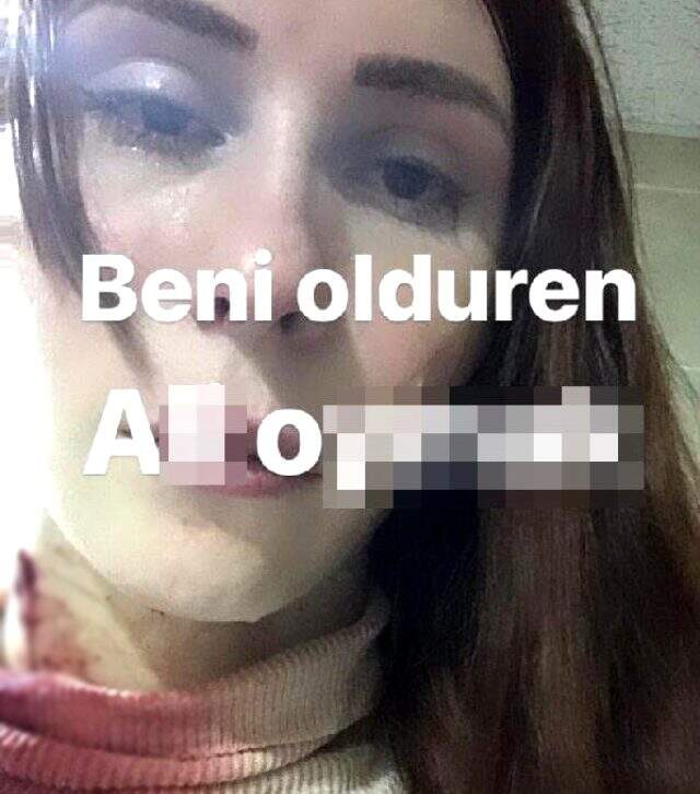WhatsApp durumunda yayınladığı kanlı fotoğrafla katiline işaret eden trans birey, evinde ölü bulundu WhatsApp durumunda yayınladığı kanlı fotoğrafla katiline işaret eden trans birey, evinde ölü bulundu