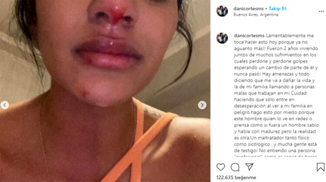 Boca'lı futbolcu sevgilisi Villa'dan şiddet gören Daniela Cortes: Artık dayanamıyorum