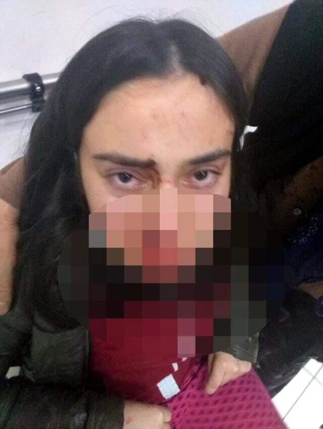 Ağabeyinin, annesi ve kendisini darbettiği genç kız: Bizi öldürecek