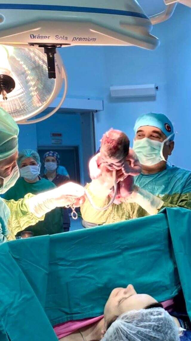Eşinin sezaryen ameliyatını gerçekleştiren doktor, çifte mutluluk yaşadı Eşinin sezaryen ameliyatını gerçekleştiren doktor, çifte mutluluk yaşadı