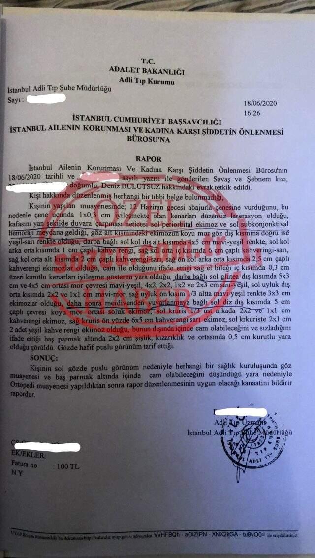 Ozan Güven'den şiddet gördüğünü iddia eden Deniz Mutlutsuz'un darp raporunda onlarca morluk ve çürük tespit edildi