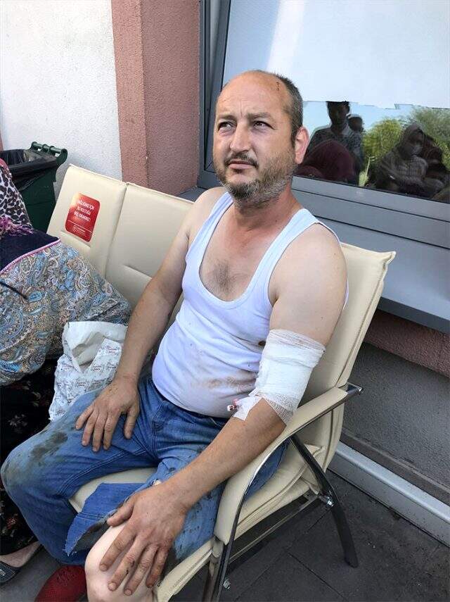 Patlamada yaralanan işçi Recep Ersoy, olay anını anlattı: Patlama ilk vurduğu zaman beni 10 metre fırlattı Patlamada yaralanan işçi Recep Ersoy, olay anını anlattı: Patlama ilk vurduğu zaman beni 10 metre fırlattı