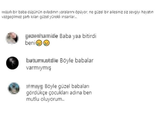 Survivor'da duygusal anlar! Cemal Can'ın babası oğlunun dizileri yaraları öptü Survivor'da duygusal anlar! Cemal Can'ın babası oğlunun dizileri yaraları öptü