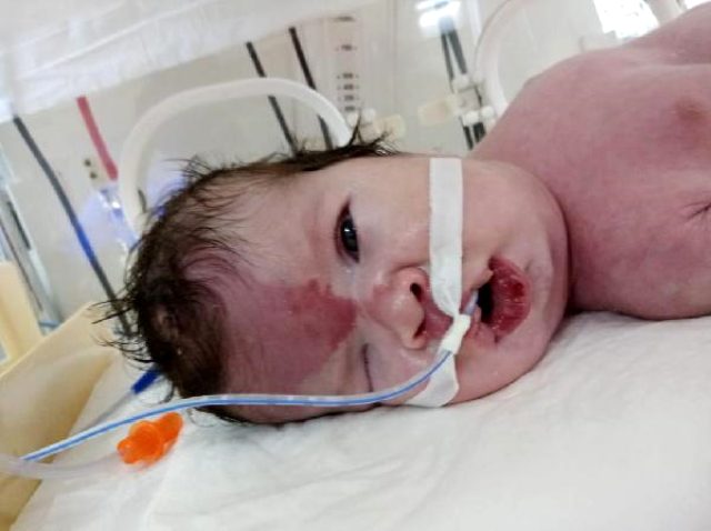 Doğum raporunda erkek olan bebek kız çıktı; aile hastaneden şikayetçi oldu