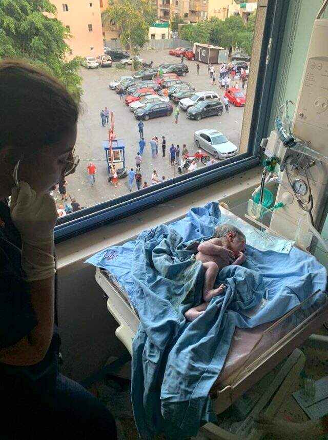 Beyrut'ta bir kadın patlamaya doğumhanede yakalandı Beyrut'ta bir kadın patlamaya doğumhanede yakalandı
