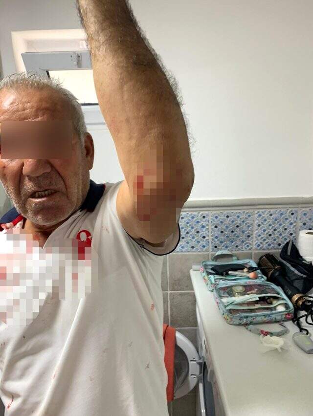 'Kiracısınız, bu yolu kullanamazsınız' gerekçesiyle yaşlı adama saldırdılar 'Kiracısınız, bu yolu kullanamazsınız' gerekçesiyle yaşlı adama saldırdılar