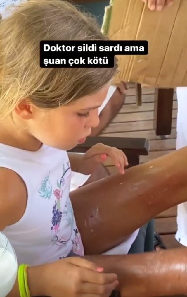 Şarkıcı Yeliz Yeşilmen'in kızının bacaklarına kaynar su döküldü