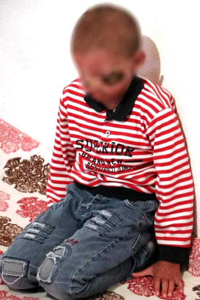 Cilt kanseri nedeniyle dışarı çıkamayan 8 yaşındaki çocuk için annesi yardım istiyor