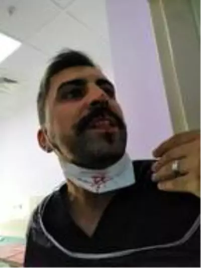 Sağlık çalışanlarına şiddet bitmiyor! Hasta yakını, sosyal mesafe uyarısı yapan hemşirenin burnunu kırdı