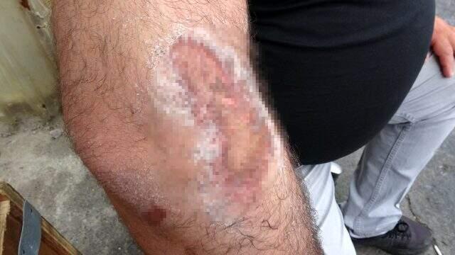 Çalışanlarının maaşını kaptırmamak için metrelerce böyle sürüklendi