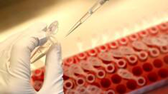 <a class='keyword-sd' href='/koronavirus/' title='Koronavirüs'>Koronavirüs</a> aşısı: Oxford Üniversitesi ve AstraZeneca'nın testleri bir deneğin rahatsızlanması...