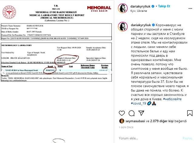 Çeşme'de dayak yediğini söyleyen model Daria Kyryliuk, koronavirüse yakalandı