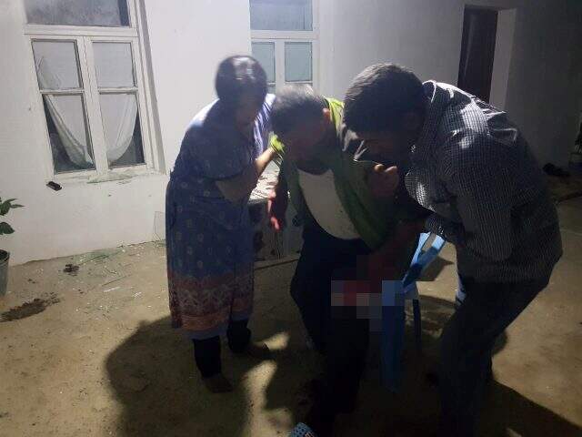 Ermenistan'ın havanlarla hedef aldığı Azerbaycanlı sivillere ait ilk foto0ğraflar yayınlandı Ermenistan'ın havanlarla hedef aldığı Azerbaycanlı sivillere ait ilk foto0ğraflar yayınlandı