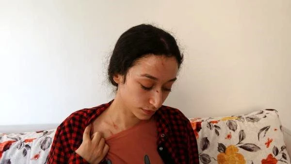 Eşinden şiddet gören engelli Buse'nin acı feryadı: 7 aylık bebeğimi de 12'nci katın balkonundan sarkıttı