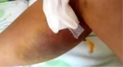 Kayınvalidesini önce darbedip, sonra silahla ateş eden damada 11 yıl hapis istemi