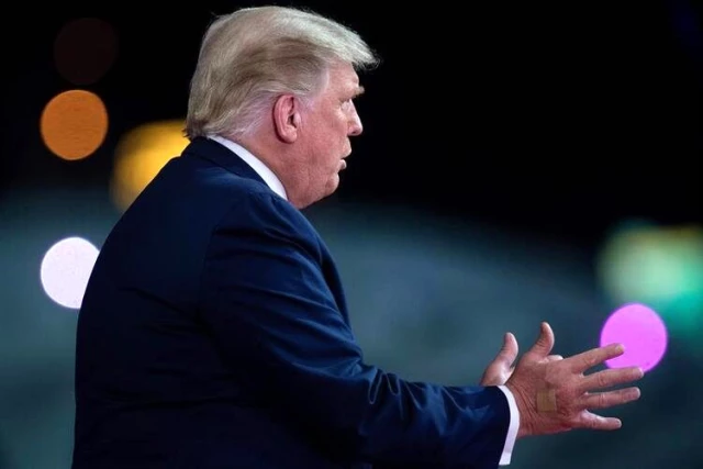 ABD Başkanı Trump canlı yayına katıldı, elinin üzerindeki detay tartışma yarattı