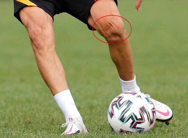 İki kez ayağı kırılan Galatasaraylı, Emre Akbaba'nın bacağının son hali üzüntü yarattı