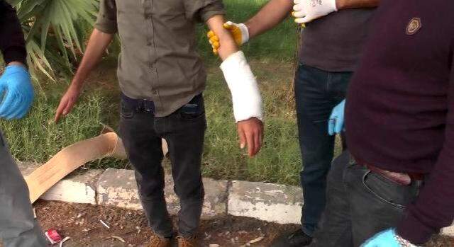 Saldırı hazırlığındaki terörist, zaman ayarlı bomba düzeneğini kolundaki alçıda kamufle etmiş Saldırı hazırlığındaki terörist, zaman ayarlı bomba düzeneğini kolundaki alçıda kamufle etmiş