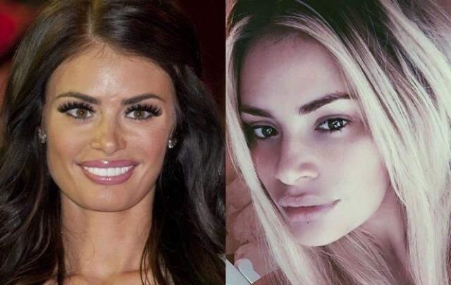 Dünyaca ünlü yıldız Chloe Sims estetik yorumlarına isyan etti: Operasyon geçirmedim