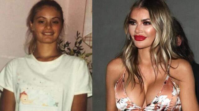 Dünyaca ünlü yıldız Chloe Sims estetik yorumlarına isyan etti: Operasyon geçirmedim