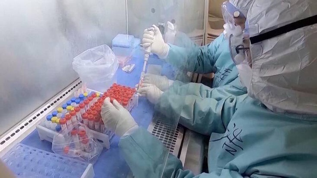 Wuhan'da koronavirüsü yaydığı iddia edilen laboratuvardan Prof. Shi: Ziyarete açığız