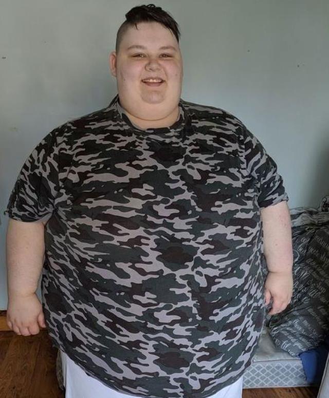 Cinsiyet değiştirmek için gittiği doktor, aşırı kilolarından dolayı 5-10 yıl içinde öleceğini söyledi