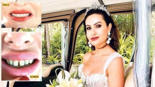 Hande Erçel'in dişlerinden yaptırmak isteyen ünlü modacının başına gelmeyen kalmadı