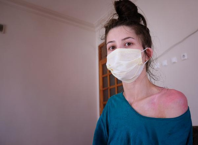 Eşi ile kızını sıcak suyla haşlayan adam hakkında iddianame hazırlandı! 6 yıla kadar hapsi ve suyun 'silah' sayılması isteniyor Eşi ile kızını sıcak suyla haşlayan adam hakkında iddianame hazırlandı! 6 yıla kadar hapsi ve suyun 'silah' sayılması isteniyor