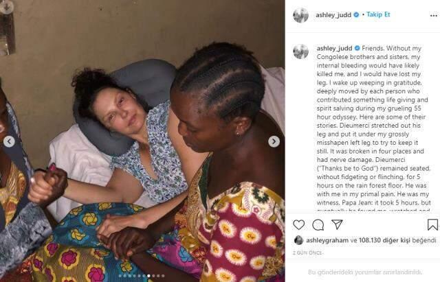 Issız ormanda bacağını kıran oyuncu Ashley Judd, 55 saatte hastaneye ulaştı