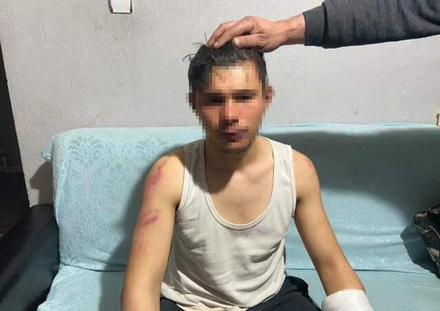 16 yaşındaki genci, 200 TL yüzünden 5 saat boyunca dinlene dinlene dövdüler