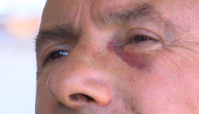 Tecavüz iftirasıyla 15 kişinin linç etmeye kalktığı diş hekimi konuştu: Görüntüler olmasaydı kendimi anlatamazdım Tecavüz iftirasıyla 15 kişinin linç etmeye kalktığı diş hekimi konuştu: Görüntüler olmasaydı kendimi anlatamazdım