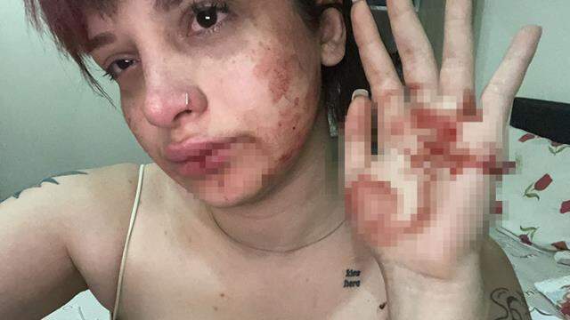 Sosyal medya fenomeni kız arkadaşını tayt giydiği için darbeden oyuncu, serbest bırakıldı Sosyal medya fenomeni kız arkadaşını tayt giydiği için darbeden oyuncu, serbest bırakıldı