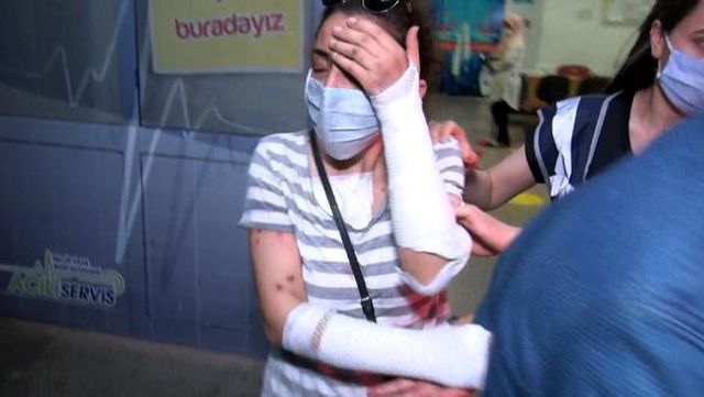 Erkek arkadaşını yüzüne kezzap attı, tahliye edildi