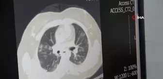 Uzman doktordan 'aşı olun' çağrısı