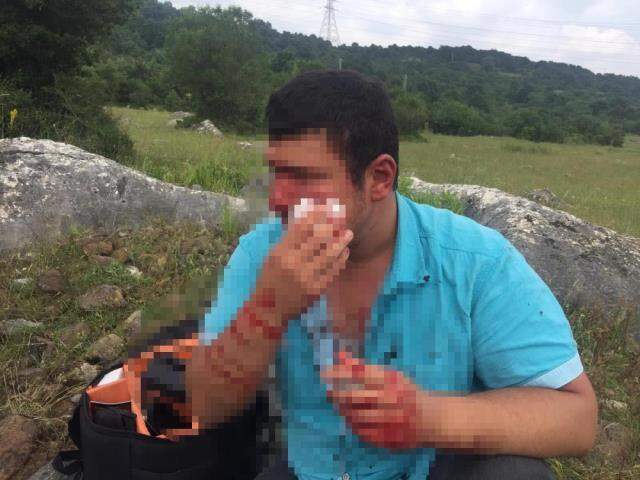 Lütfü Türkkan'ın kaçak çiftliğin yıkımını görüntüleyen muhabir darbedildi Lütfü Türkkan'ın kaçak çiftliğin yıkımını görüntüleyen muhabir darbedildi