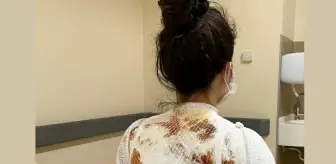 Eşinin kaynar suyla yaktığı Rukiye A: 'Ölmek istemiyorum'