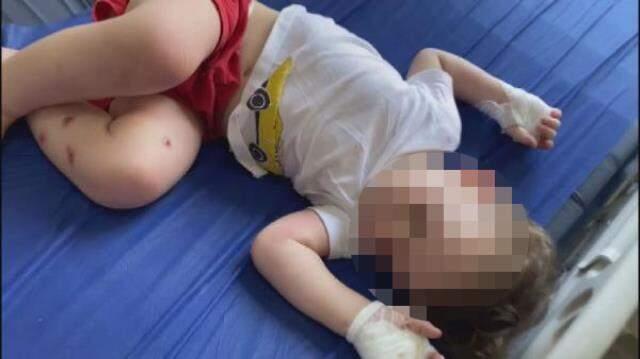 1,5 yaşındaki bebeğine işkence yaptığı iddia edilen babaya meydan dayağı 1,5 yaşındaki bebeğine işkence yaptığı iddia edilen babaya meydan dayağı