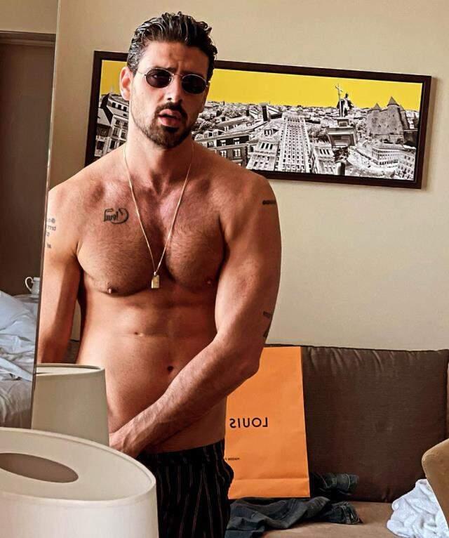 Oyuncu Michele Morrone, meme ucu operasyon geçirmek için Türkiye'ye geldi