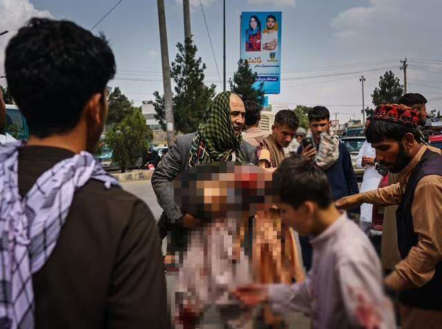 Bu görüntülere yürek dayanmaz! Taliban zulmü çocukları da kanlar içinde bıraktı Bu görüntülere yürek dayanmaz! Taliban zulmü çocukları da kanlar içinde bıraktı