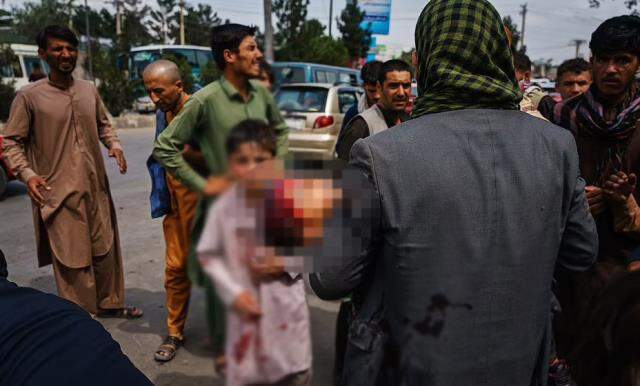 Bu görüntülere yürek dayanmaz! Taliban zulmü çocukları da kanlar içinde bıraktı Bu görüntülere yürek dayanmaz! Taliban zulmü çocukları da kanlar içinde bıraktı