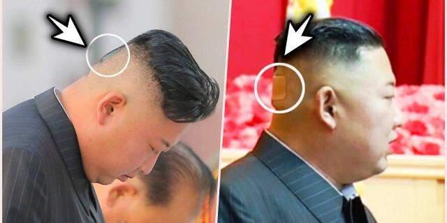 Kilo veren ve boynu ortaya çıkan Kim Jong-Un'un eski halinden eser kalmadı