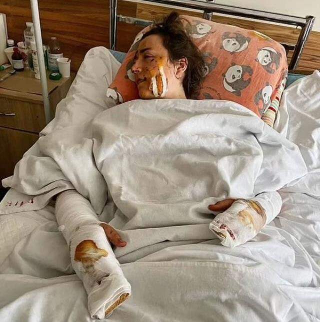 Balayında korkunç son! Yeni evli çiftin yaktığı ateş, Birinci Dünya Savaşı'ndan kalma bombayı patlattı Balayında korkunç son! Yeni evli çiftin yaktığı ateş, Birinci Dünya Savaşı'ndan kalma bombayı patlattı