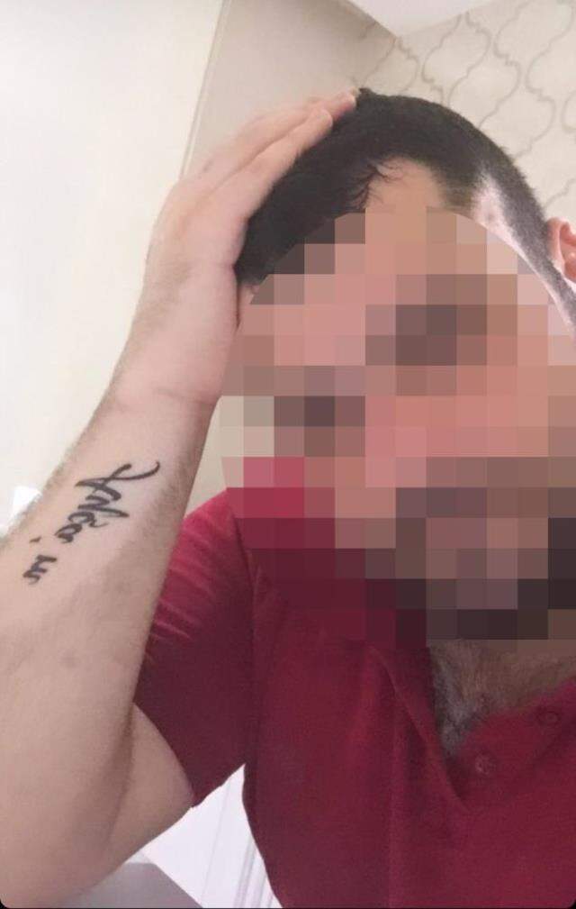 Saplantılı aşık dehşeti! Önce tabancayla vurdu sonra darp edip yüzünü kesti Saplantılı aşık dehşeti! Önce tabancayla vurdu sonra darp edip yüzünü kesti