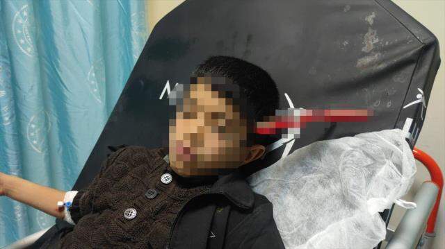 10 yaşındaki çocuğun kafasına saplanan makasla hastaneye getirildi 10 yaşındaki çocuğun kafasına saplanan makasla hastaneye getirildi
