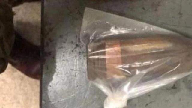 Kalçasından top mermisi çıktı, polis hastaneye patlayıcı ekibi gönderdi! Kalçasından top mermisi çıktı, polis hastaneye patlayıcı ekibi gönderdi!